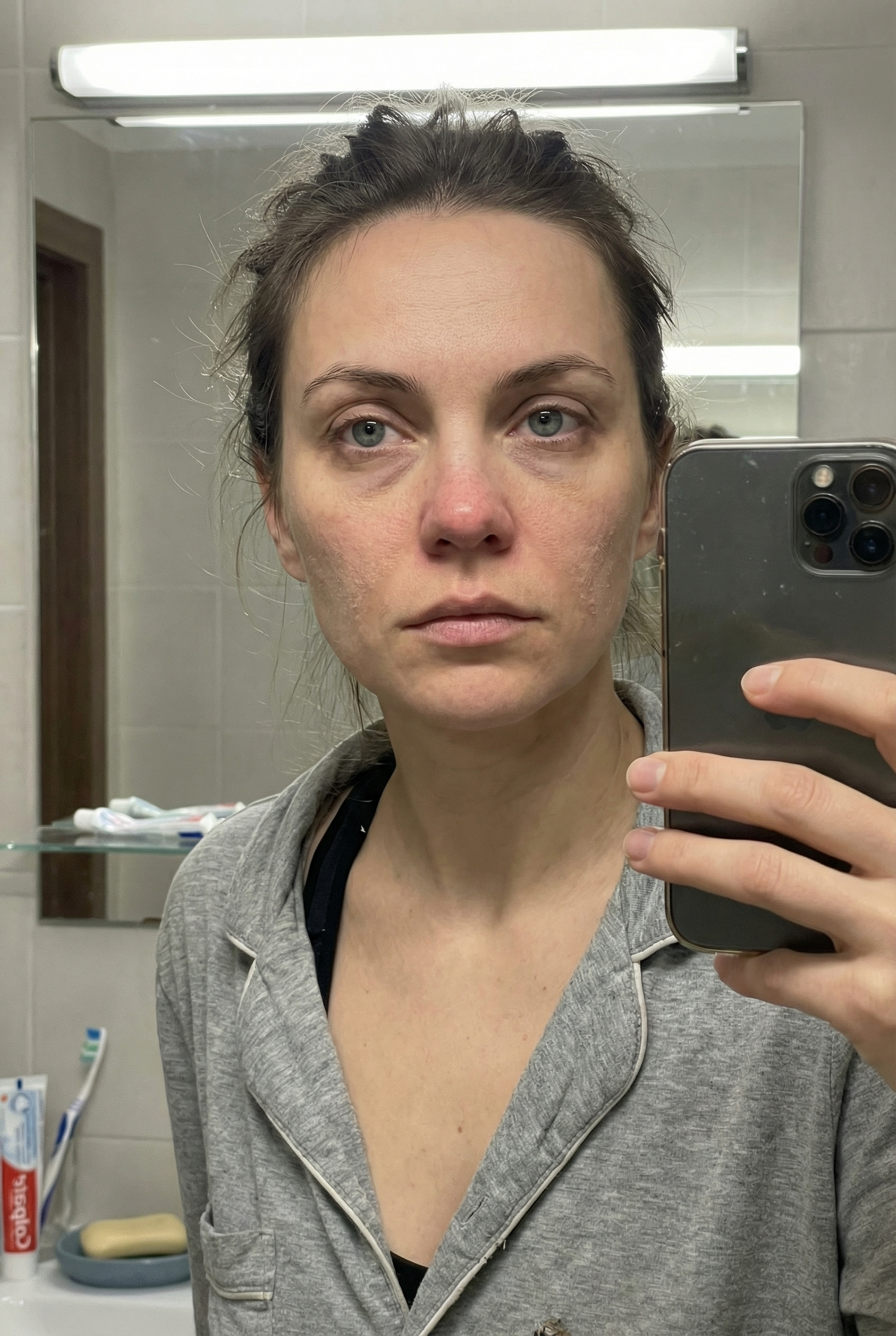 Before - Real Results. Real People. No Filters.